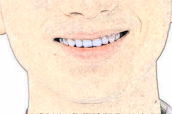 2024哈爾濱242醫(yī)院口腔科正畸做的好嗎？哪位醫(yī)生做的好