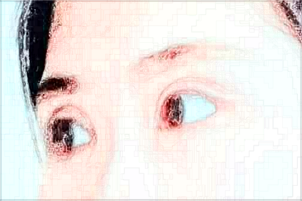 2024蘇州第四人民醫(yī)院近視手術(shù)做的好嗎？哪位醫(yī)生做的好