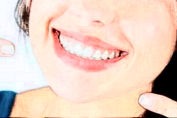 江蘇大學(xué)附屬醫(yī)院口腔科牙齒矯正價(jià)目表(價(jià)格表)怎么樣