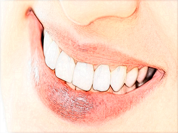 2024中山大學(xué)附屬口腔醫(yī)院洗牙多少錢(qián)?洗牙有什么好處