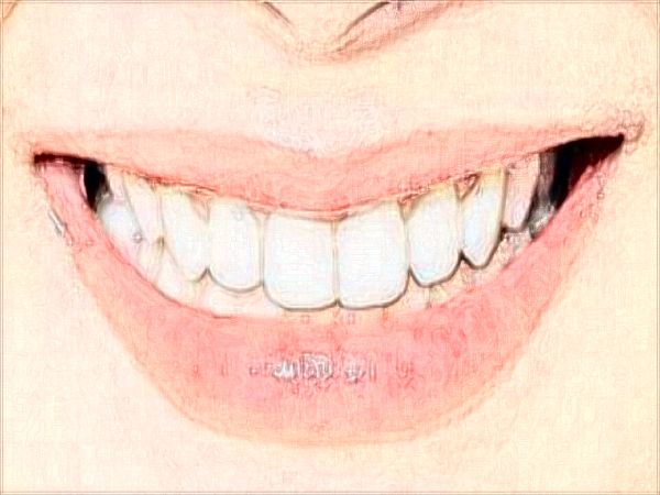 2024中山大學附屬口腔醫(yī)院洗牙收費標準?洗牙能讓牙變白?