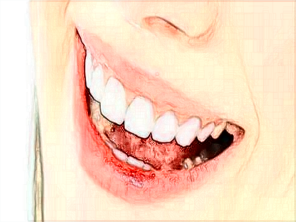 中山大學(xué)附屬口腔醫(yī)院口腔正畸科的范圍?2024正畸科價(jià)格