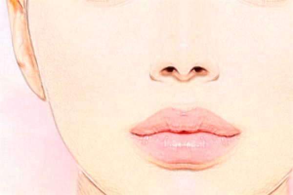 2024青島市立醫(yī)院去痣多少錢?去痣應該去哪個科