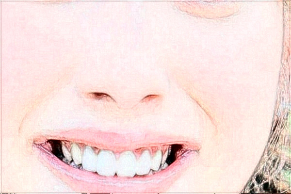 2024阜陽市人民醫(yī)院激光脫毛價(jià)格多少？做的怎么樣