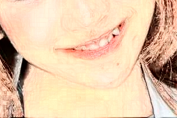 金華市中醫(yī)院口腔科牙齒修復(fù)做的好嗎？哪位醫(yī)生做的好