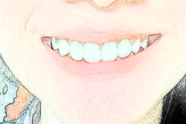 金華市中醫(yī)院口腔科牙齒修復(fù)做的好嗎？哪位醫(yī)生做的好