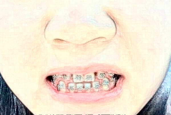 江蘇大學(xué)附屬醫(yī)院口腔科牙齒修復(fù)怎么樣_哪個(gè)醫(yī)生比較好