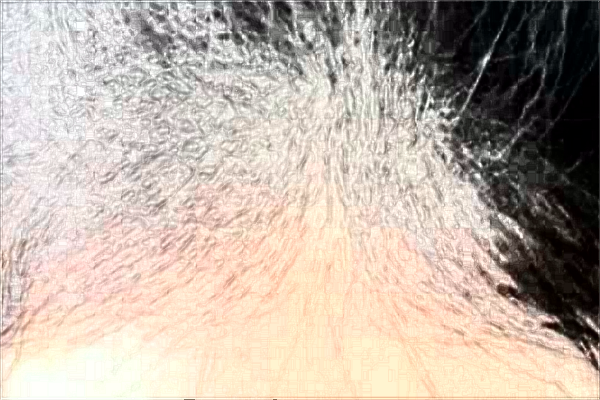 江蘇大學(xué)附屬醫(yī)院植發(fā)怎么樣_哪個(gè)醫(yī)生比較好