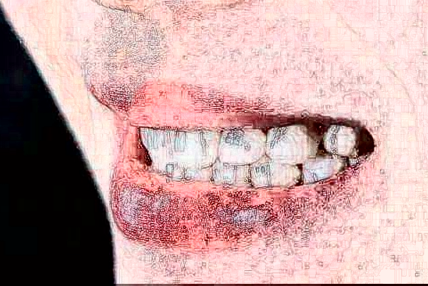 天津醫(yī)科大學(xué)第二醫(yī)院口腔科義齒修復(fù)價目表(價格表)怎么樣