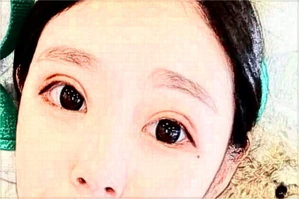 保定市第一中心醫(yī)院割雙眼皮怎么樣_哪位醫(yī)生比較好