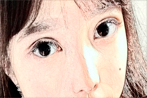 保定市第一中心醫(yī)院割雙眼皮怎么樣_哪位醫(yī)生比較好