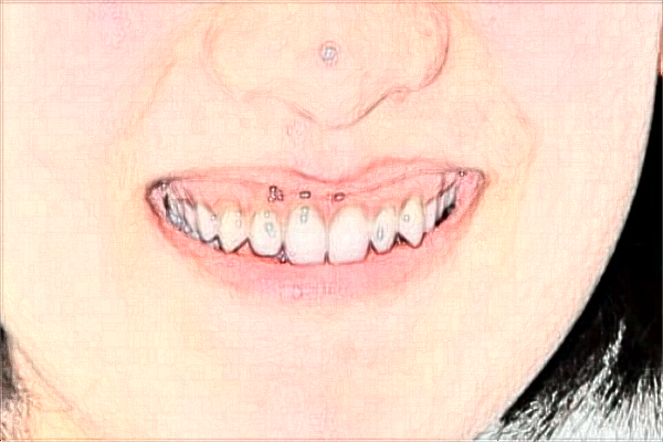 2024南京中大醫(yī)院口腔科口腔正畸做的好嗎？醫(yī)生排名