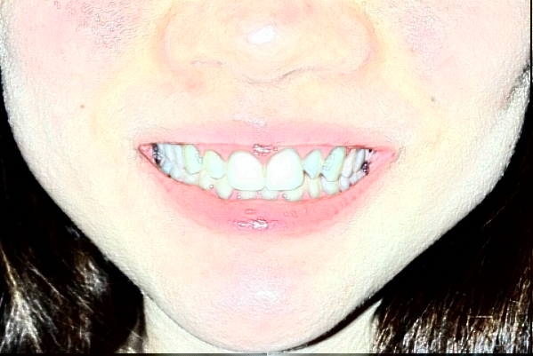 金華市中醫(yī)院口腔科牙體牙髓好嗎？牙體牙髓要多少錢