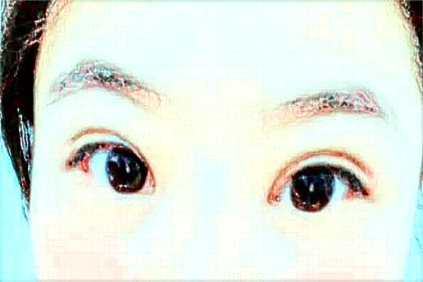 杭州市第一人民醫(yī)院近視激光手術(shù)做的怎么樣？醫(yī)生推薦