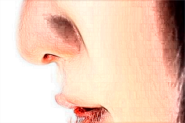 南京鼓樓醫(yī)院熱拉提做的好嗎？誰做的好