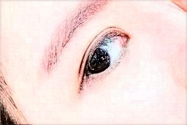 溫州醫(yī)學(xué)院附屬第一醫(yī)院做雙眼皮怎么樣_大概需要多少錢