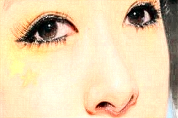 江蘇大學(xué)附屬醫(yī)院激光洗眼線怎么樣?實(shí)測(cè)案例分享