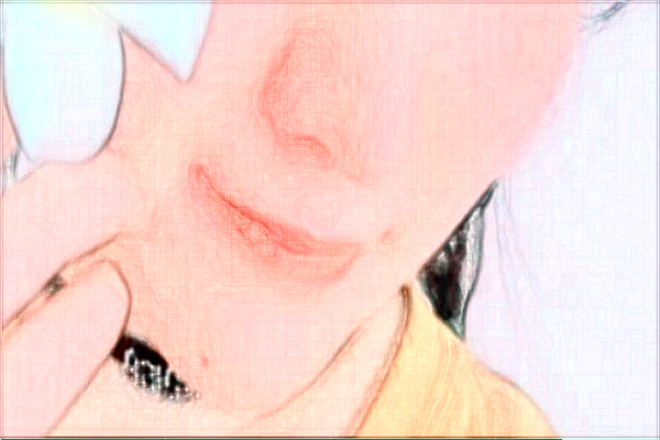 金華市中醫(yī)院光子嫩膚多少費(fèi)用？醫(yī)生排名