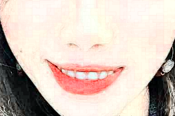 2024天津醫(yī)科大學(xué)第二醫(yī)院口腔科種植牙做的好嗎_體驗(yàn)分享