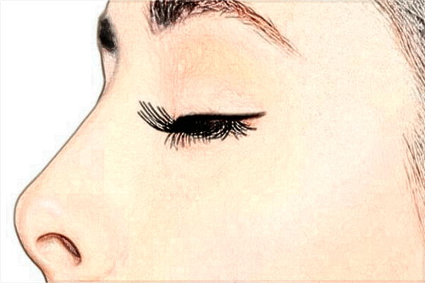 中山大學附屬第一醫(yī)院光子嫩膚怎么樣?光子嫩膚能維持多久