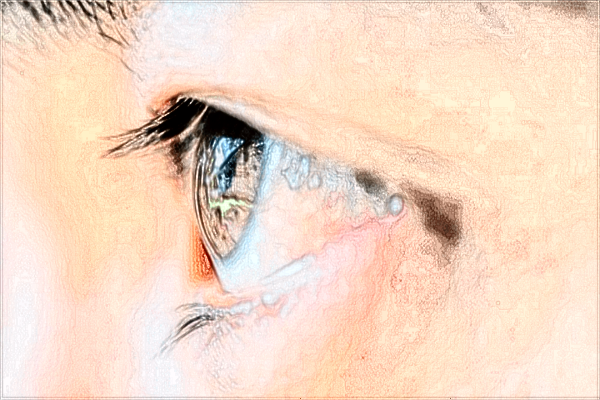 中山大學(xué)附屬第一醫(yī)院激光近視怎么樣?2024激光近視價格