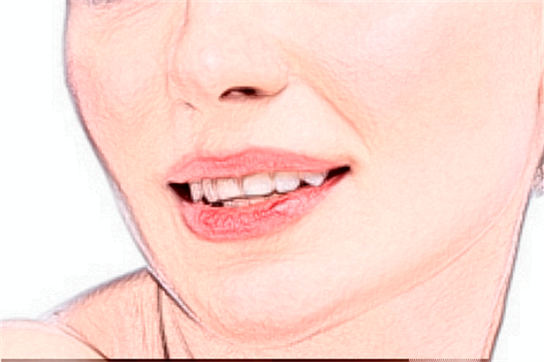 惠州市中心人民醫(yī)院祛黃褐斑貴嗎?祛黃褐斑有效方法