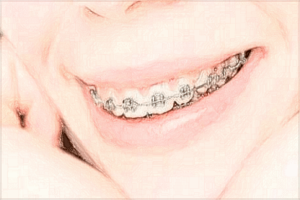 2024青島市立醫(yī)院正畸費用?正畸和矯正有什么區(qū)別