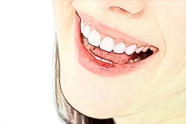 青島市婦女兒童醫(yī)院牙科好嗎?2024牙科收費價目表