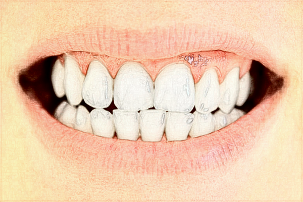 中山大學(xué)附屬口腔醫(yī)院正畸醫(yī)生好嗎?2024收費(fèi)價(jià)格