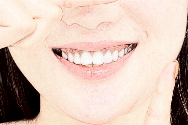 中山大學(xué)附屬口腔醫(yī)院正畸醫(yī)生好嗎?2024收費(fèi)價(jià)格