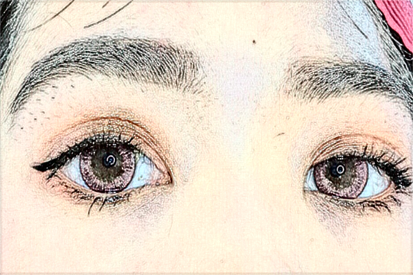 阜陽市人民醫(yī)院割雙眼皮做的好嗎？誰做的好？