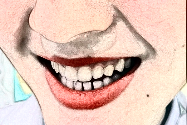 大連新華醫(yī)院口腔科埋伏齒拔除價格表_醫(yī)生推薦