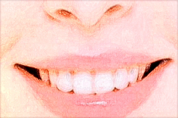 貴陽醫(yī)學院附屬醫(yī)院牙科專家哪個好?牙齒矯正比較好的醫(yī)生