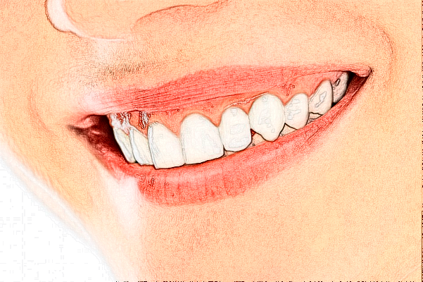 2024安徽省立醫(yī)院牙齒矯正需要多少錢?醫(yī)生推薦