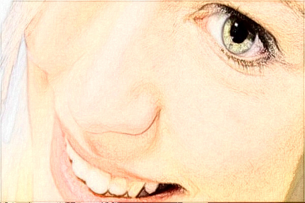 2024天津醫(yī)院光子嫩膚做的好嗎?整形日記分享