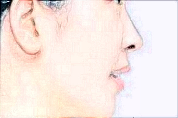 南京鼓樓醫(yī)院做的好嗎？誰做的好