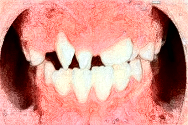 貴陽(yáng)市第一人民醫(yī)院口腔科綜合怎么樣?2024收費(fèi)價(jià)格如何