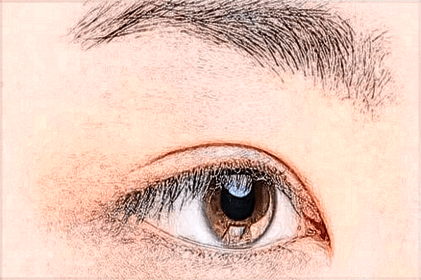 南寧303醫(yī)院近視手術(shù)需要休息幾天?2024激光近視手術(shù)價格