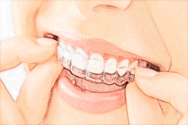 山東省千佛山醫(yī)院口腔科王國(guó)相怎么樣?口碑好不好?