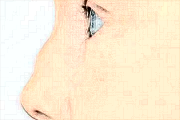 哈爾濱醫(yī)科大學附屬第一醫(yī)院隆鼻做的好嗎_隆鼻整形日記分享