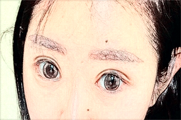 南京鼓樓醫(yī)院全飛秒激光手術(shù)多少錢?醫(yī)生名單推薦