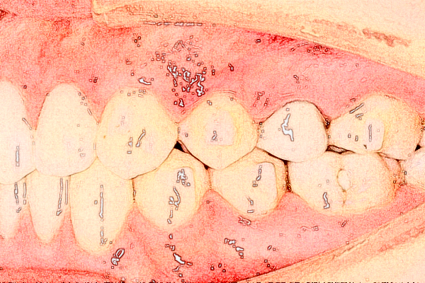 蘇州大學(xué)附屬兒童醫(yī)院口腔科正畸價(jià)目表(價(jià)格表)怎么樣