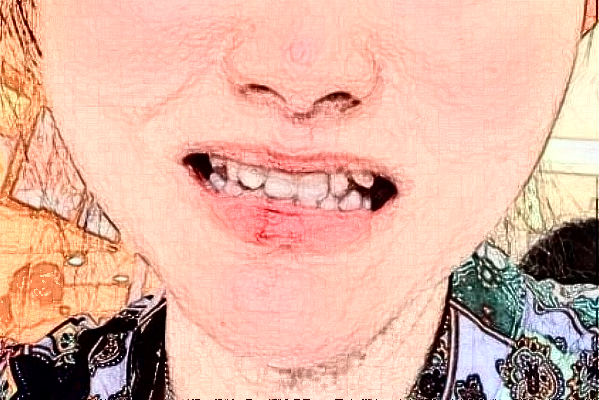 2024無錫市第一人民醫(yī)院口腔科正頜怎么樣_醫(yī)生名單推薦