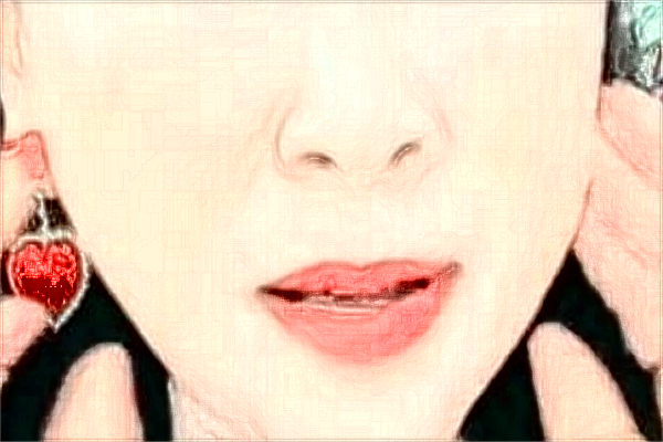 杭州市第一人民醫(yī)院激光脫毛做的好嗎?案例反饋