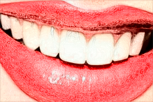 2024中山大學(xué)附屬第三醫(yī)院補牙怎么樣?補牙材料是什么