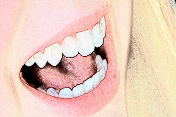 2024蘭州大學第二醫(yī)院補牙多少錢?補牙后一般能維持幾年