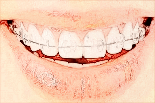 常德市第一人民醫(yī)院牙科醫(yī)生好嗎?2024牙科醫(yī)生收費(fèi)高嗎