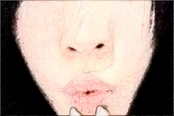 2024揚州市第一人民醫(yī)院激光祛斑怎么樣?全新案例分享