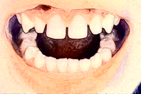 南通大學(xué)附屬醫(yī)院隱形正畸做的好嗎？誰做的好