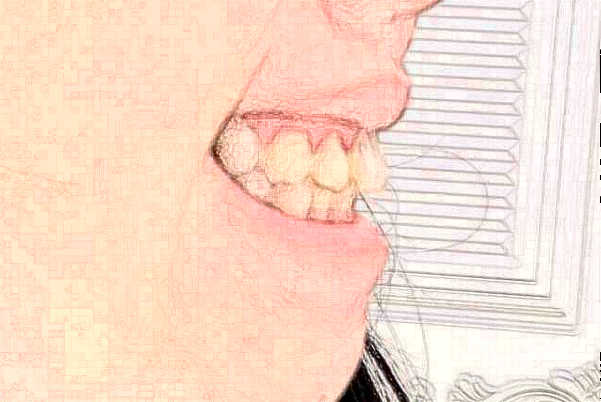 江蘇大學(xué)附屬醫(yī)院口腔科錯牙合畸形矯正怎么樣_專家名單